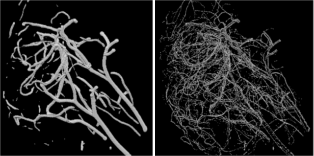 segmentations of 3D resin cast model of rat brain microvasculature