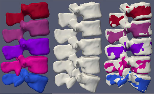 3D vertebrae segmentation comparison