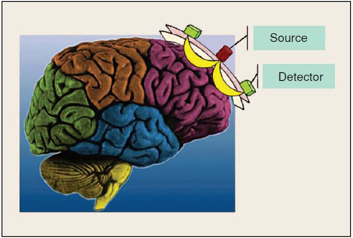 fNIRS uses near infra-red light to measure oxygen levels in the frontal cortex, associated with working memory.